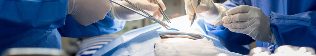 Chirurgia Vascolare Clinica Napoli