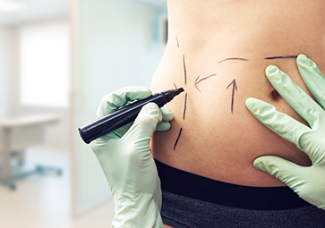 Chirurgia plastica, ricostruttiva ed estetica Napoli