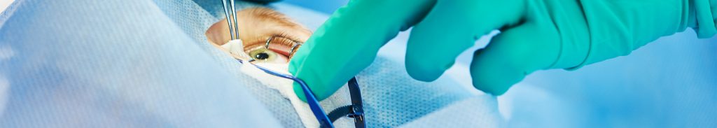 Chirurgia Oculistica Clinica Napoli