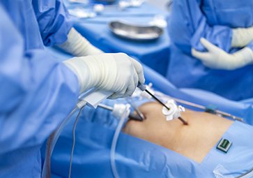 Chirurgia urologica Clinica Napoli