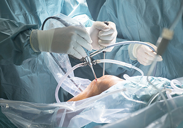 Interventi di Traumatologia e ortopedia Napoli