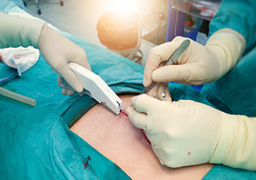 Chirurgia ginecologica Clinica Napoli