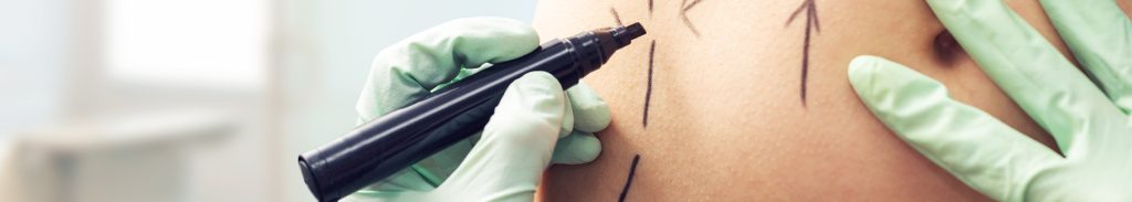 Chirurgia plastica, ricostruttiva ed estetica Napoli