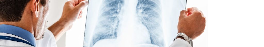 Pneumologia Napoli